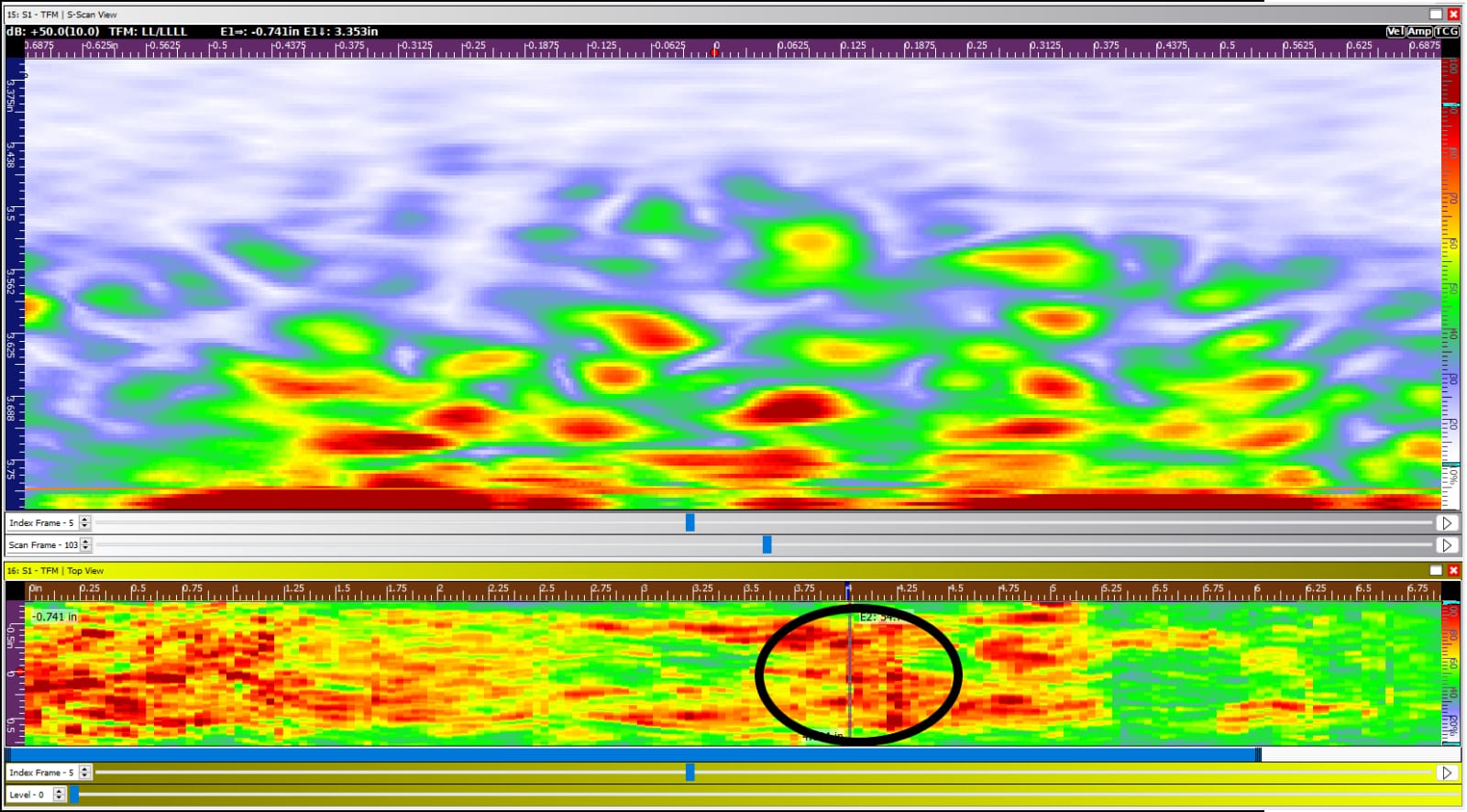 This area would be considered as Stage 3 HTHA, using the FlawTech sample as a reference guide. Small, but high amplitude and concentrated indications.
