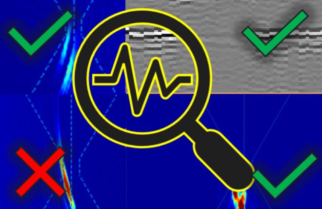 Recent TFM Study Recap: Where Are We Today?